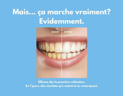 Bandes Blanchissantes PAP + (28 STRIPS)